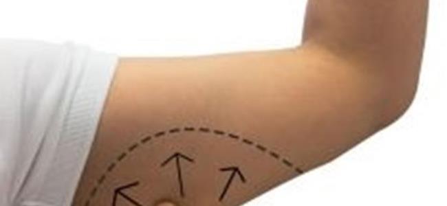 هكذا يمكنك التخلص من الدهون الزائدة في الذراعين