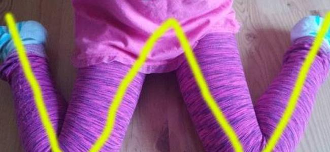 تحذير هام للأهل ...امنعوا أطفالكم من الجلوس بهذه الوضعية!