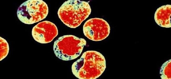 خطر يهدد بتدمير مناعة البشر