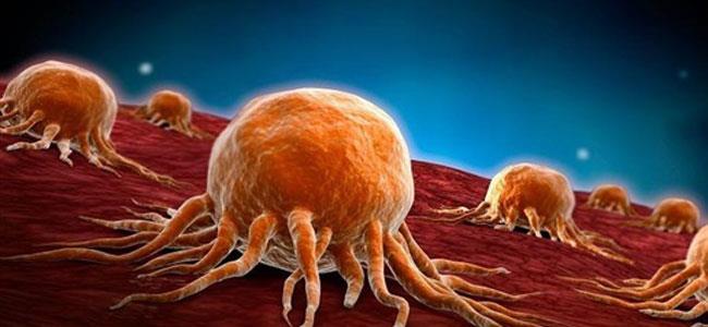 علاج جديد يقضي على السرطان المتقدّم...