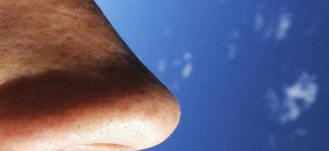 حالات مرضية يكشفها الأنف