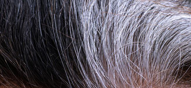 أسباب ظهور الشعر الأبيض في سن مبكر