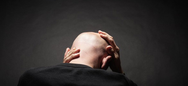 تلوث الهواء يسبب الصلع لدى الرجال!