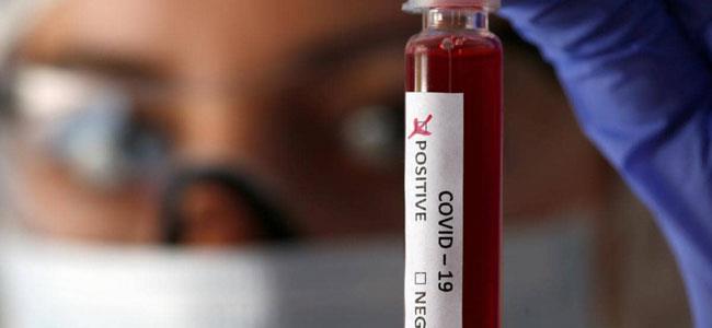 الأبحاث تكشف فصيلة الدم الأكثر عرضة لخطر كورونا