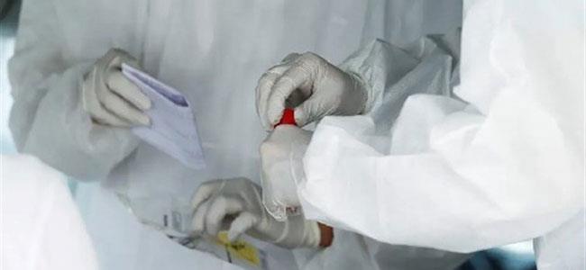 العالم مشغول.. هل يعود كورونا بعد الشفاء؟