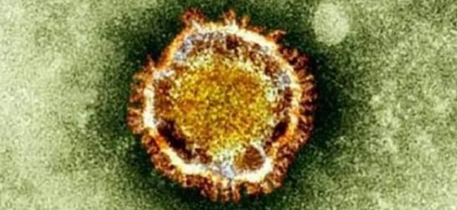  فنانة عربية تعلن إصابتها بفيروس كورونا