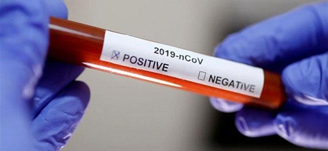 أول فنانة سورية تعلن عن إصابتها بفيروس كورونا!