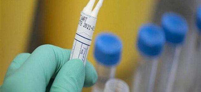 تجارب سريرية على عقار ضدّ كورونا