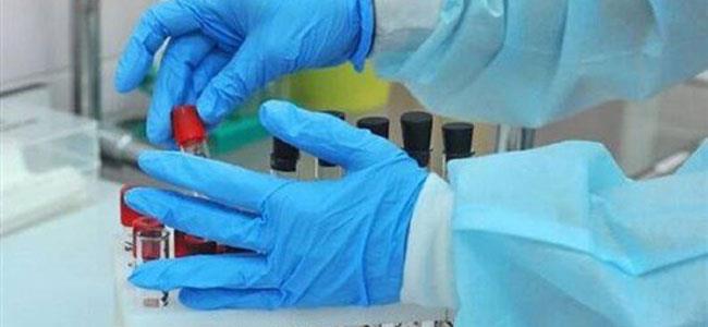 شركة تكشف: هذا الدواء يعالج المصابين بكورونا