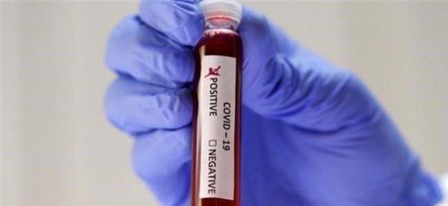  كورونا يخطف فنانة