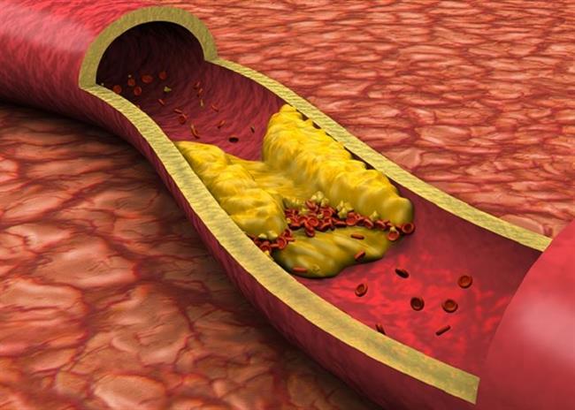 نصائح لخفض مستوى الكوليسترول في الدم