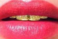 اغلى ابتسامة في العالم بـ153 الف دولار