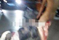 إمرأة تقطع عضو زوجها الذكري..وترميه من شرفة المستشفى