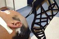 ضربت زوجها على رأسه بنعل حذائها...والنتيجة