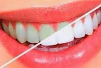 وصفة سريعة لأسنان ناصعة البياض!