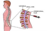 فيروس خطر يهدد اللبنانيين وكلفة العلاج 30 ألف $