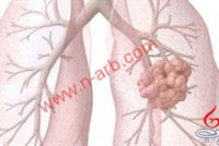 إليكم الطعام الوحيد الذى ينظف الرئتين كليا من اثار التدخين ..تعرفوا عليه !!!