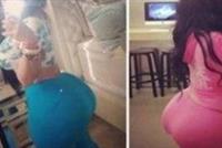 بالصور: شابة تواجه الموت بعد إنفجار مؤخرتها