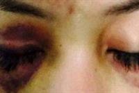 رجل أعمال يعتدي على ممثلة. من هما؟