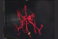 لبناني في عالم الاغتراب يتفوق... طبيّا