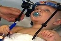 معجزة طبية... إعادة رأس رضيع فصله حادث سير