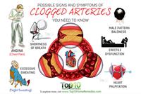 10 علامات لانسداد الشرايين.. إياكم تجاهلها!