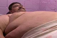 أضخم رجل في العالم يخضع لجراحة تصغير معدة