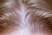 طريقة سحرية لإعادة إنبات الشعر في أسبوع واحد!