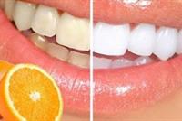 بيّضي أسنانك بـ 60 ثانية فقط... إليك الوصفة الطبيعية!