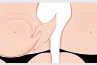 افعلوا شيئًا واحدًا كل صباح لتخسروا الوزن بشكل لافت!