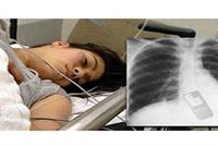 برازيلية تبتلع هاتفها الجوال بسبب...