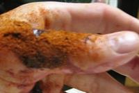 بهذه الطريقة.. تضمد جرحك خلال ثوانٍ