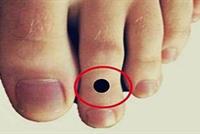 هل إصبع قدمك الثاني أطول من أصابعك الأخرى. إذن عليك أن تقرأ هذا.