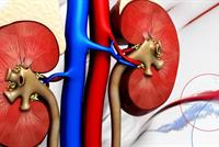 نصائح للوقاية من الفشل الكلوي