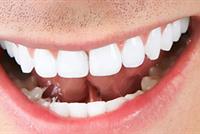 هذه الأخطاء الشائعة قد تدمر أسنانك!