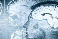 هذه العلاقة بين اضطرابات النوم والذاكرة!