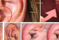 هل لديك شعر على أذنك؟ علامة تحذيرية من خطر محدق!