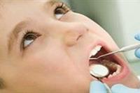 وداعاً للحشوة التقليدية للأسنان