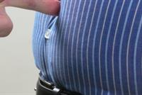 كيف يمكن التخلص من الكرش جراحياً؟