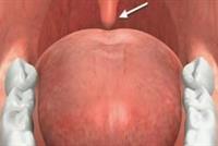 ما هي أهمية اللهاة المتدلية في نهاية الحلق؟