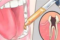 ضعوا هذا الخليط على السنّ.. وسيختفي الألم كالسحر