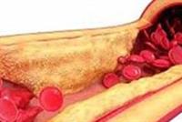 مشروب سحري يفتح الشرايين بصورة مذهلة خلال 20 يوما