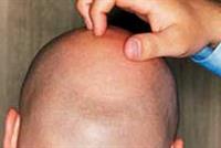 مفاجأة للرجال: لا تخجلوا من الصلع