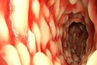  تناولوا هذه السلطة لمدة 3 أيام... النتيجة ستذهلكم!