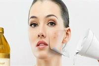  10 استعمالات تجميليّة لخل التفاح.. تعرّفي عليها