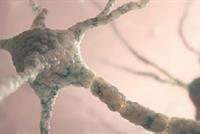 اكتشاف طريقة واعدة لعلاج مرض الزهايمر