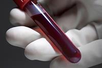 ما هي أخطر فئة دمّ؟