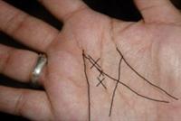 هل يظهر الحرف X  على راحة يدك؟