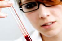 حذارِ.. الكولسترول يرتفع في الشتاء!