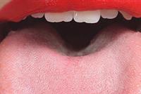  لماذا يجب تنظيف اللّسان جيّدًا؟